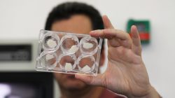 Yaakov Nahmias, founder and chief scientist of Future Meat Technologies, holds laboratory-grown fat samples in his lab in Jerusalem May 2, 2018. REUTERS/Ammar Awad