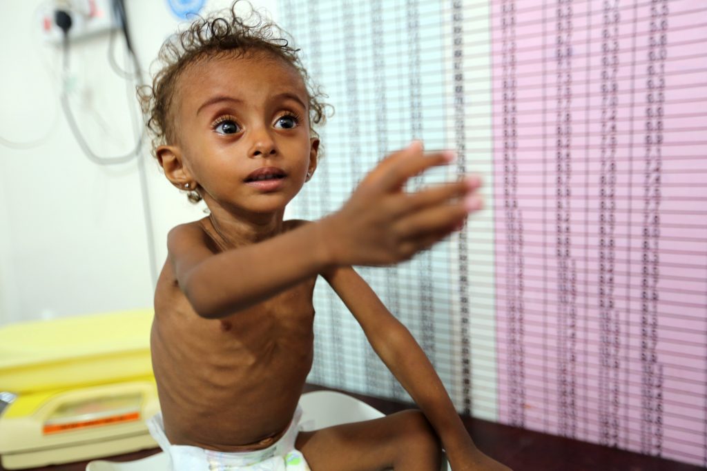 Calls for end to Yemen war offer little hope for hungry children
